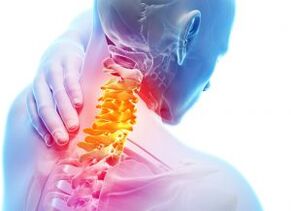 Dor e abrigos na zona cervical com o terceiro grau de osteocondrose